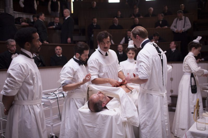 The Knick5
